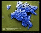 streptococcus micrograph